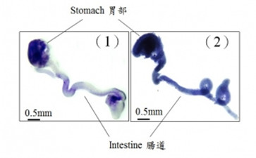 香港大學李嘉誠醫(yī)學院發(fā)現(xiàn)影響腸神經(jīng)細胞發(fā)育的新基因變異